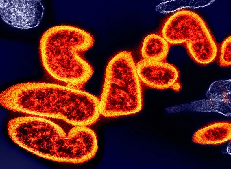 Colorized transmission electron micrograph of mature extracellular Nipah virus particles.