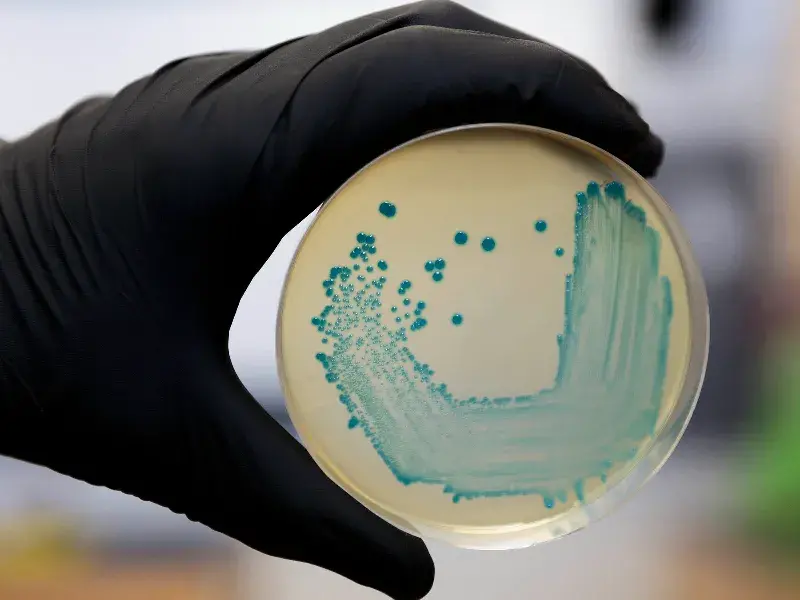 Listeria monocytogenes isolated on agar from a food sample.